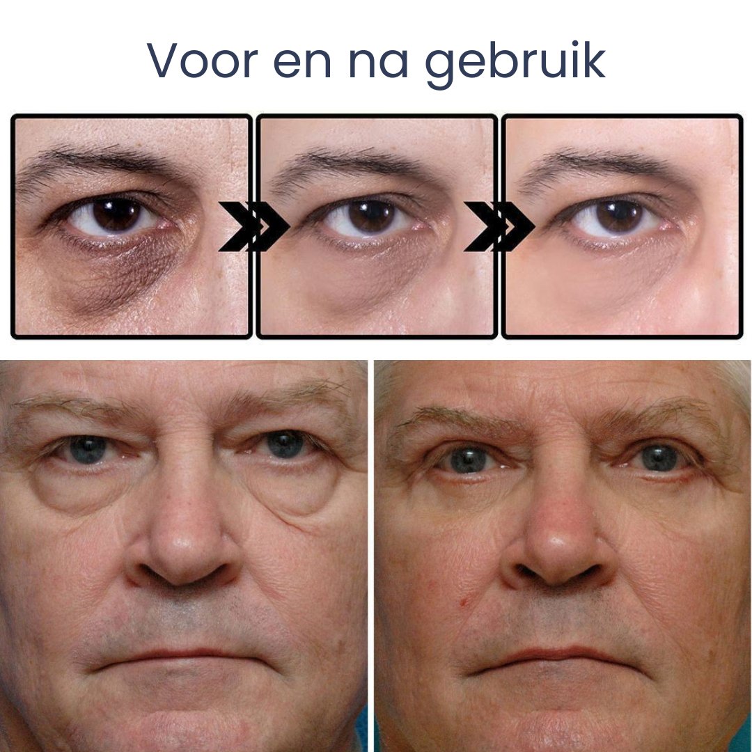 EastMoon™ Lifting Ooggel