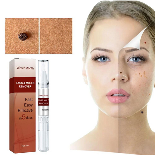 WipeOff™ Wrat en moedervlek verwijderaar