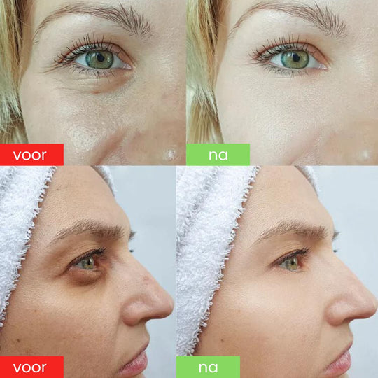 FirmEye™ Verstrakkende Oogcrème